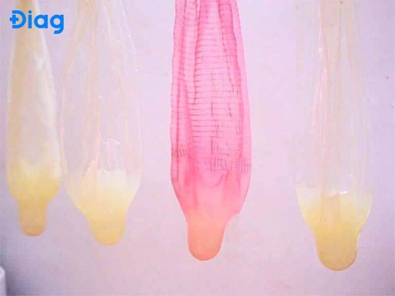 Tại sao tinh trùng màu vàng? Tinh trùng màu vàng nhạt có sao không?