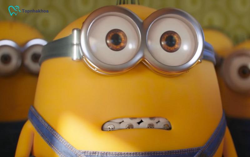 Cập nhật xu hướng Minion niềng răng mới nhất