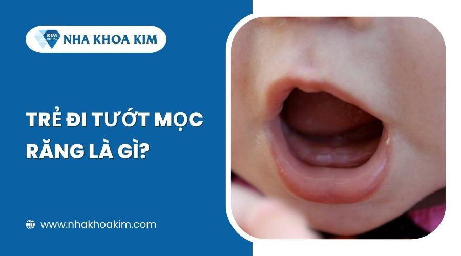 Trẻ đi tướt mọc răng là gì?