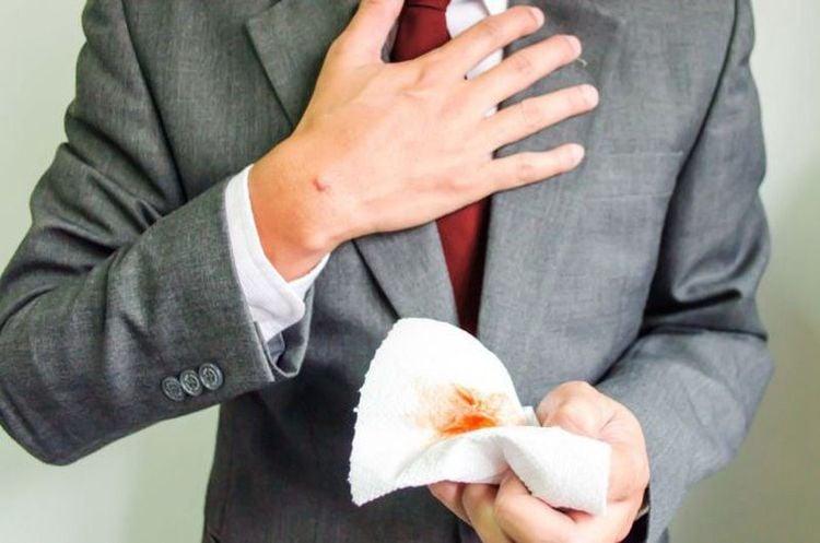 Quy trình thực hiện chụp X quang số hoá tim phổi nghiêng