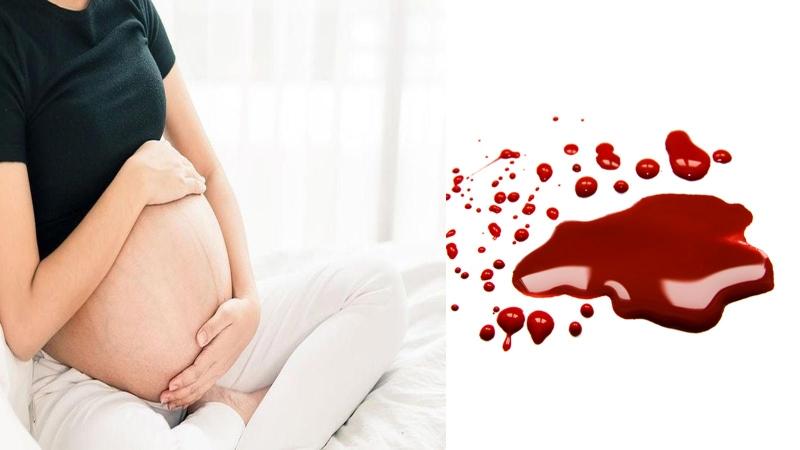 Máu báo sắp sinh là gì? Ra máu báo sau bao lâu thì chuyển dạ