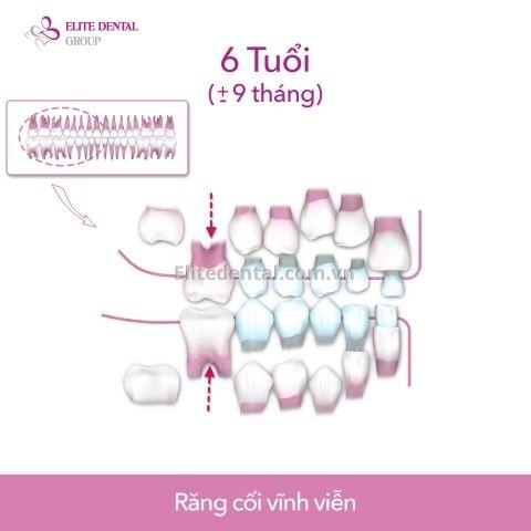 Quy Trình Thay Răng Của Trẻ Em Từ 6 – 12 Tuổi