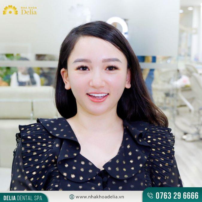 Mỉm cười là gì? Cách cười mỉm đẹp ấn tượng thu hút mọi ảnh nhìn