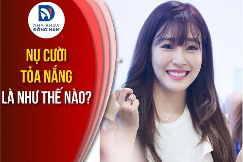 Nụ cười tỏa nắng là như thế nào? Cách để sở hữu