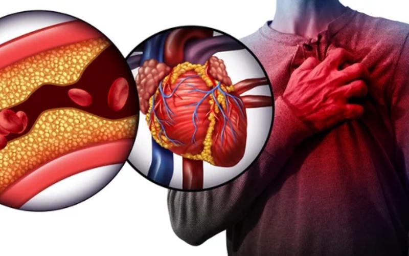 10 Biểu hiện của bệnh tim mạch dễ nhầm lẫn với các bệnh lý khác